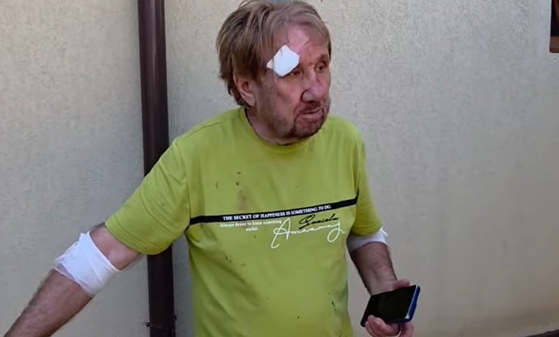 CONSTANȚA. Membru AUR, în vârstă de 74 de ani, atacat în curtea propriei locuințe! Poliţiştii îl caută pe agresor